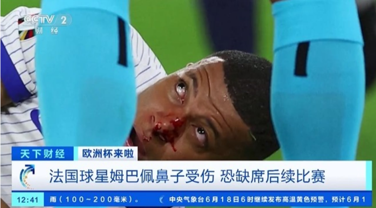 欧洲杯赛场惊魂：姆巴佩鼻伤退场，法国队前景堪忧